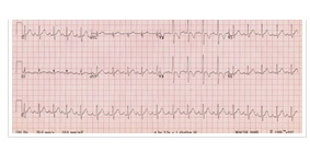 Imagem Electrocardiografia